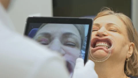 The dentist in a special computer program loaded into the tablet checks and Stock-Footage 89783163