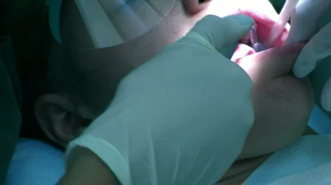 Dentist Spray Water Видео 144337