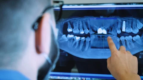 The dentist is studying the x-ray 3D image of the jaw Stock Footage 87121671