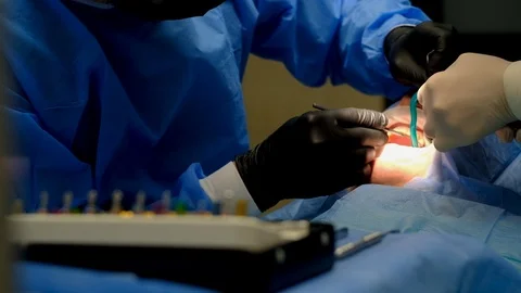 The dentist surgeon performs an implant placement operation Stock-Footage 124574741