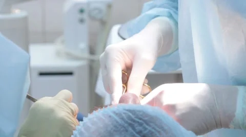 Dentist surgery Video stock 49492140