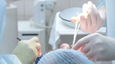 Dentist surgery Stock Footage 49492163