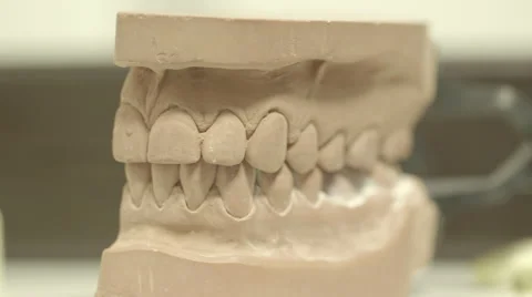 Dentist Teeth mold - focus pull Stock Footage 47673121