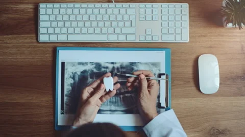 Dentist with tools and teeth x-ray Stock Footage 65379123