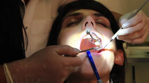 Dentist with tools removing caries and fixing tooth of female patient, close up. Stock Footage 32299852