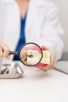Dentist with tooth Anatomy model. Oral Teeth decay and disease, Scrape off .. Stock Photos