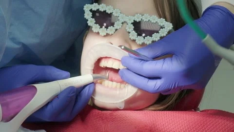 Dentist treating child teeth with drill tool Stock Footage 336665451