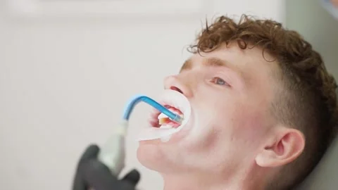 The dentist uses a special instrument to remove saliva from the patient's mouth Video stock 167303713