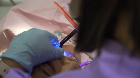 Dentist using curing light and putting dental braces Video stock 201263955