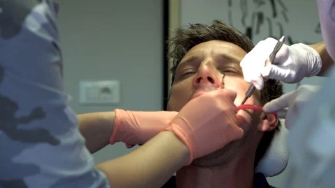 A dentist using a dental curing light Stock Footage 107742919