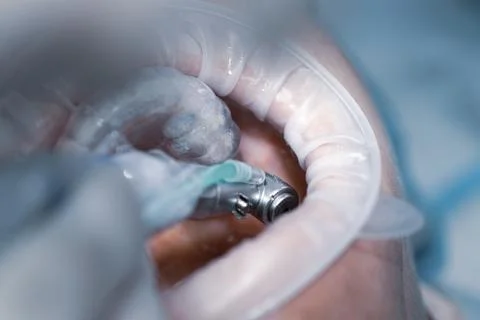 Dentist using dental drill. Close up dental drill on a light blurred background Stock Photos