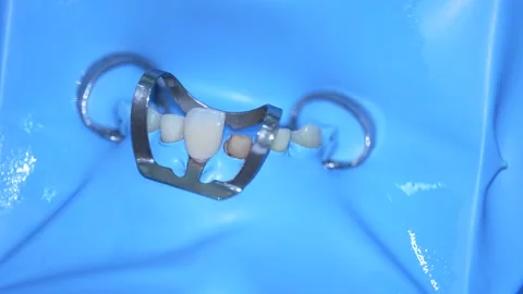 Dentist Using Dental Tool Stock Footage 316917268