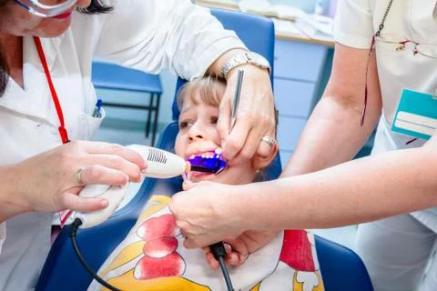 Dentist is using dental UV for curing little girl with open mouth Stock Photos