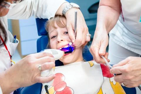 Dentist is using dental UV for curing little girl with open mouth Stock Photos