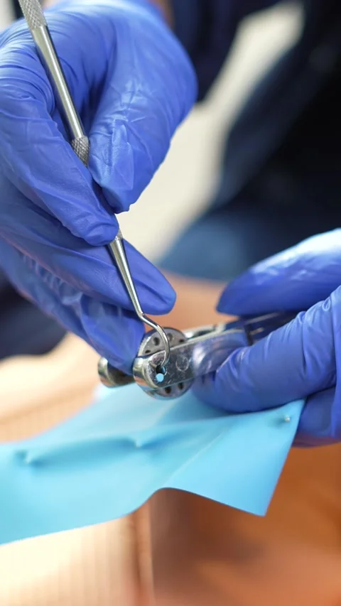 Dentist Using Instrument Stock Footage 316914563