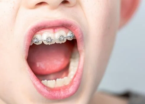 Dentist using an instrument to visualize the teeth of a child patient Stock Photos