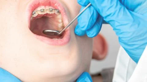 Dentist using an instrument to visualize the teeth of a child patient Stock Photos