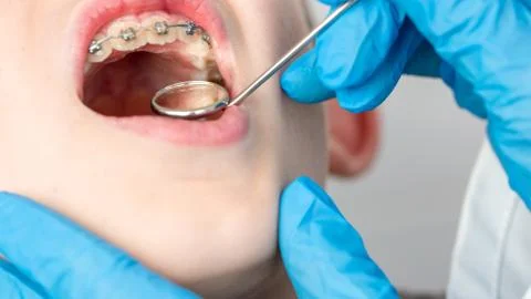 Dentist using an instrument to visualize the teeth of a child patient Stock Photos