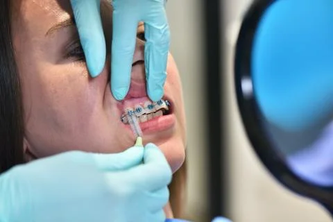 Dentist using interdental brush Foto stock