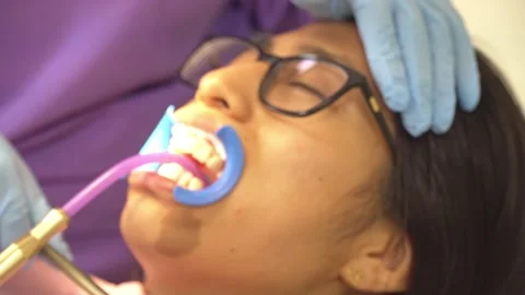 Dentist using pencil to mark teeth before orthodontia to an asian girl Video stock 187691242