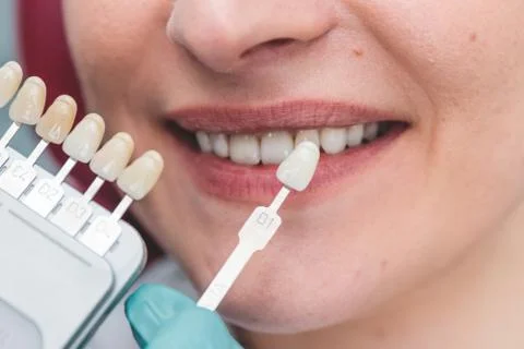 Dentist using shade guide at beautiful smile of female mouth to check the pro Photos