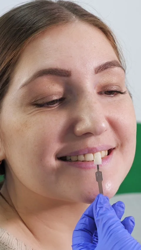 Dentist using a shade guide to select the right tooth color for a smiling womans Video stock 341578955