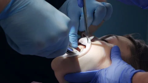 Dentist using surgical pliers to extract a tooth in the dental office. Extracted Stock Footage 159372568