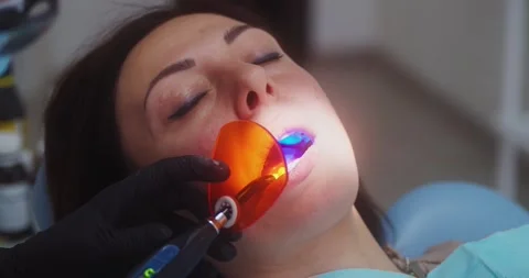Dentist using teeth uv lamp on young patient 動画素材 156413064