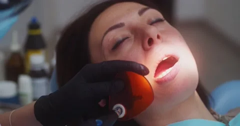 Dentist using uv lamp while treating patient's teeth 動画素材 156413013