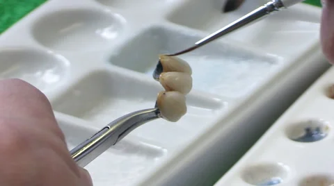 Dentist working with ceramic material, brush and dentures. Workplace dental Stock Footage 65215296