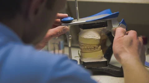 Dentist working with denture implants in laboratory. Close Up. Video stock 48921314