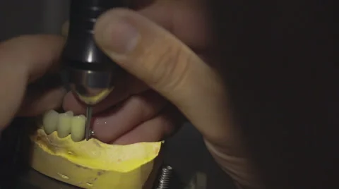 Dentist working with denture implants in laboratory. Close Up. Stock Footage 48921340