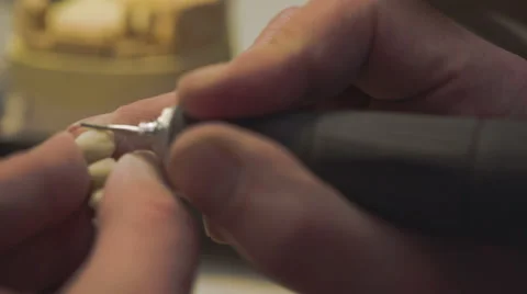 Dentist working with denture implants in laboratory.Close Up. Video stock 48921294