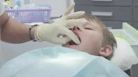 Dentist works on boy's teeth while using a mouth prop to keep jaws open Stock Footage 330482765