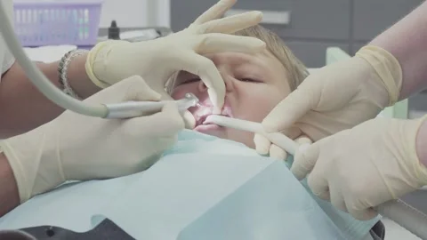 Dentist works on chipped tooth surface using drill tool for contouring repair Stock Footage 330482574