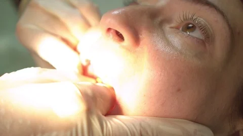 Dentist works on patient's teeth, using dental equipment. Stock Footage 90226363