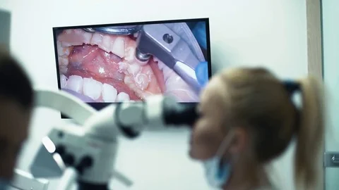Dentist workwith assistant with oral camera and monitor, looking at ocular Stock Footage 70040647
