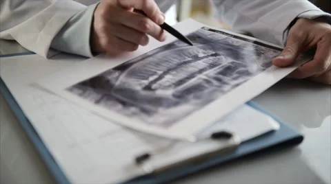 Dentist x-ray Stock Footage 60888668