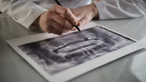 Dentist with x-ray Stock Footage 60888690