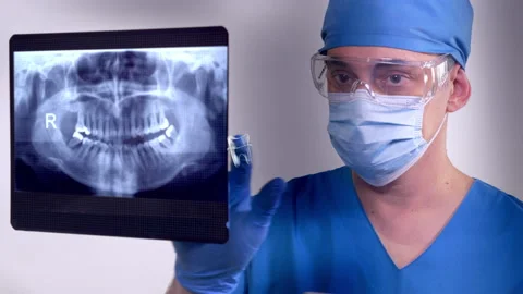 Dentist Xray Vídeo Stock 163517355