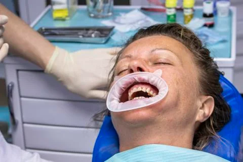 Dentistry. Stock Photos