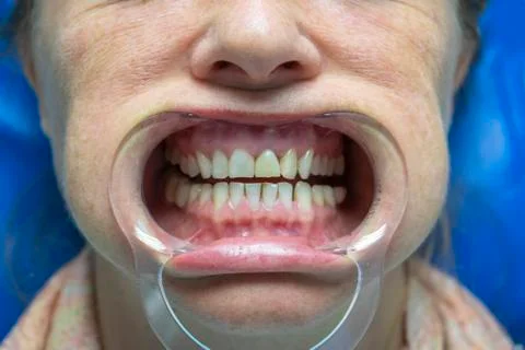 Dentistry. Stock Photos