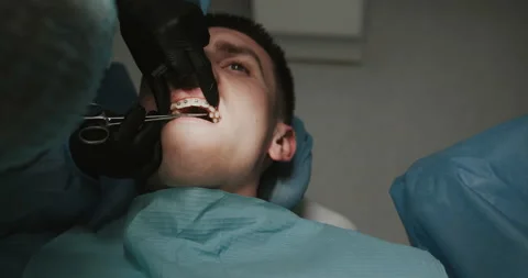 Dentistry. Surgical operation. Doctors. Braces. Stock Footage 140179014