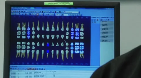 Dentist's computer screen with teeth pictures Stock Footage 8652617