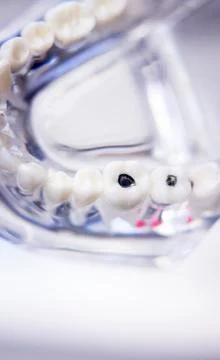 Dentists dental teeth model Stock Photos