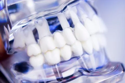 Dentists dental teeth model Stock Photos