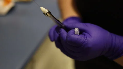 Dentist's hands preparing syringe for giving dental anesthesia to her patient. Stock Footage 197052256