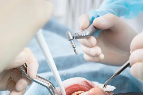 Dentist's hands in sterile gloves close-up, with an implantation tool. Stock Photos