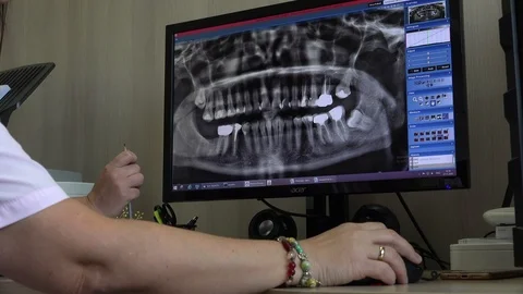 Dentists making examination of the x-ray and choosing treatment in the clinic Stock-Footage 99225775