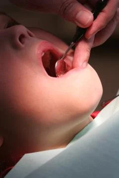 Dentists mirror Foto stock